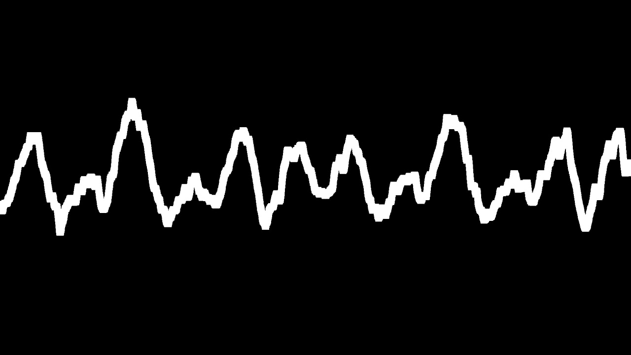 CMX - Ruoste (Live Ilosaarirock 1999)