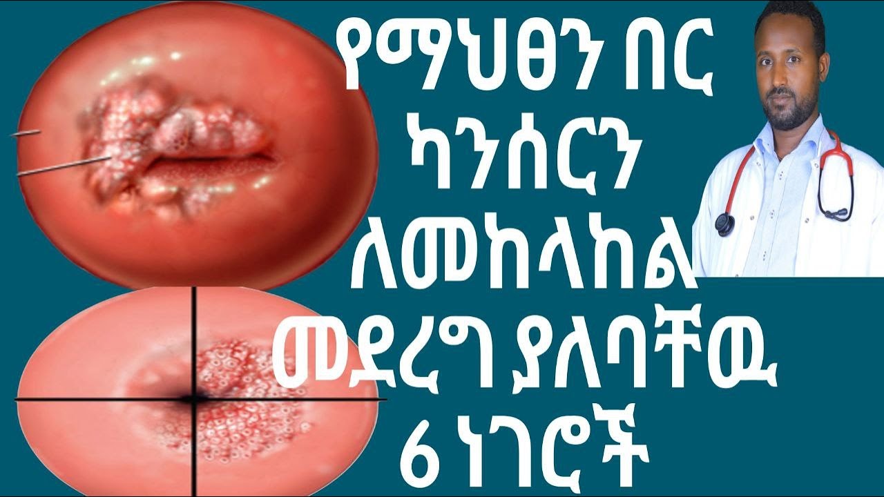 የማህፀን በር ካንሰር cervical cancer
