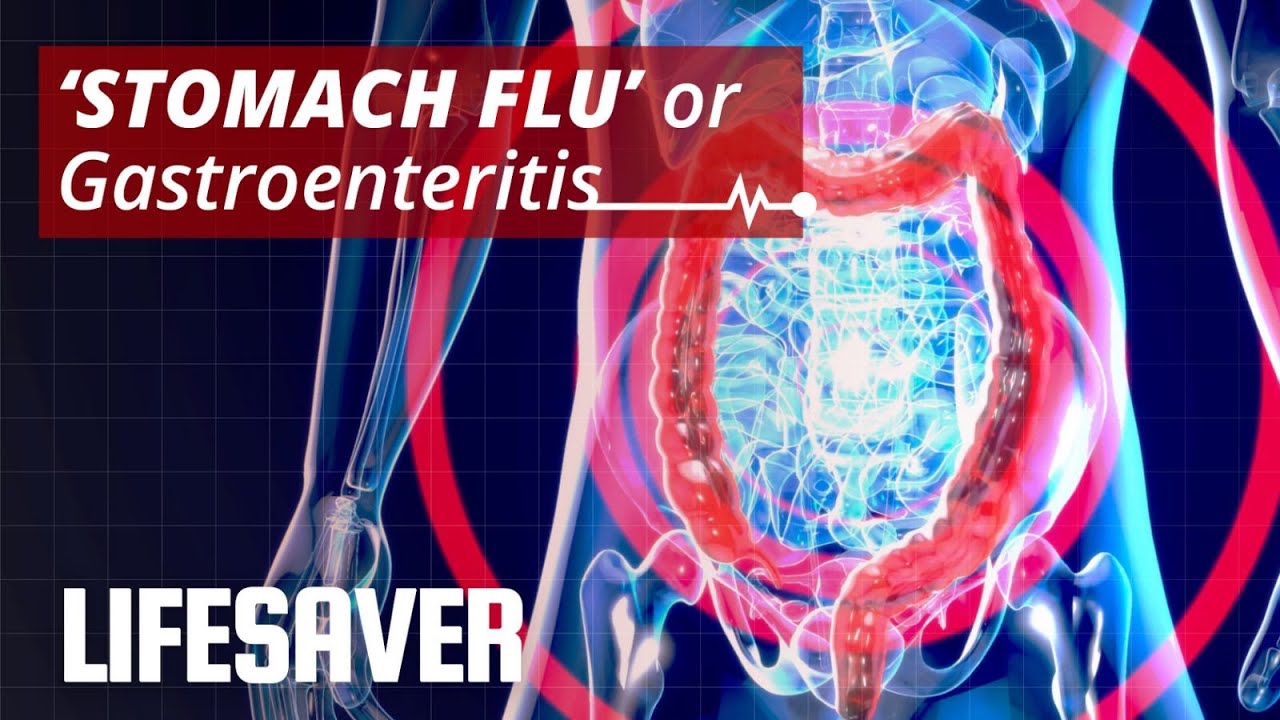 Gastroenteritis or ‘Stomach Flu’: Symptoms, Treatment, & Prevention | LIFESAVER