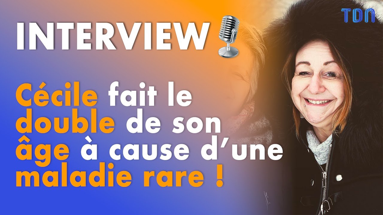 INTERVIEW 🎙 | Cécile Boiteux, atteinte de Cutis Laxa, fait le double de son âge !