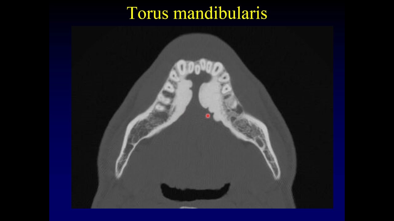 Diagnostic Imaging of the Jaw