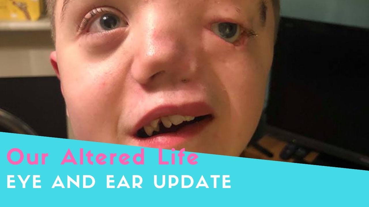 Eye and ear update