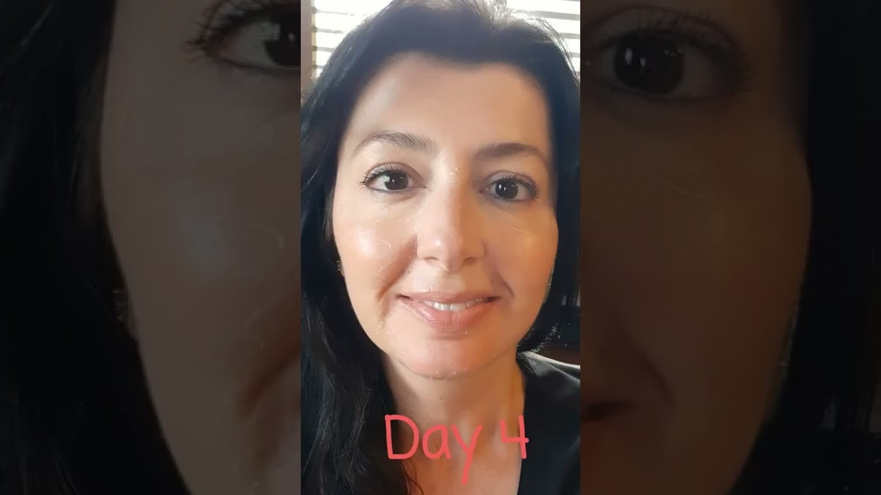 Vi Peel Precision Plus