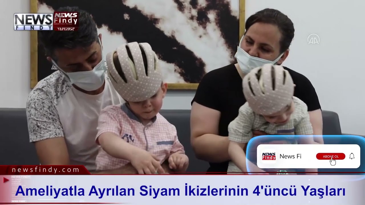Ameliyatla Ayrılan Siyam İkizlerinin 4'üncü Yaşları
