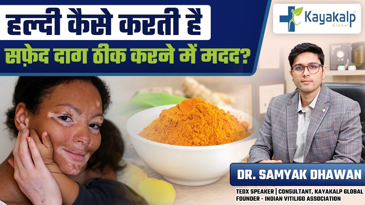 सर्दियों में हल्दी कैसे ठीक करती है सफ़ेद दाग? | Turmeric for Vitiligo Treatment | Kayakalp Global