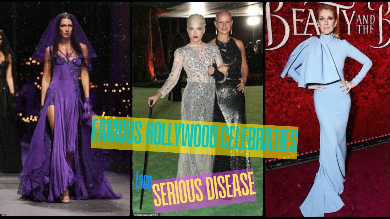 Famous Hollywood Celebrities, Famous Celebrities Shocking Face Serious Diseases