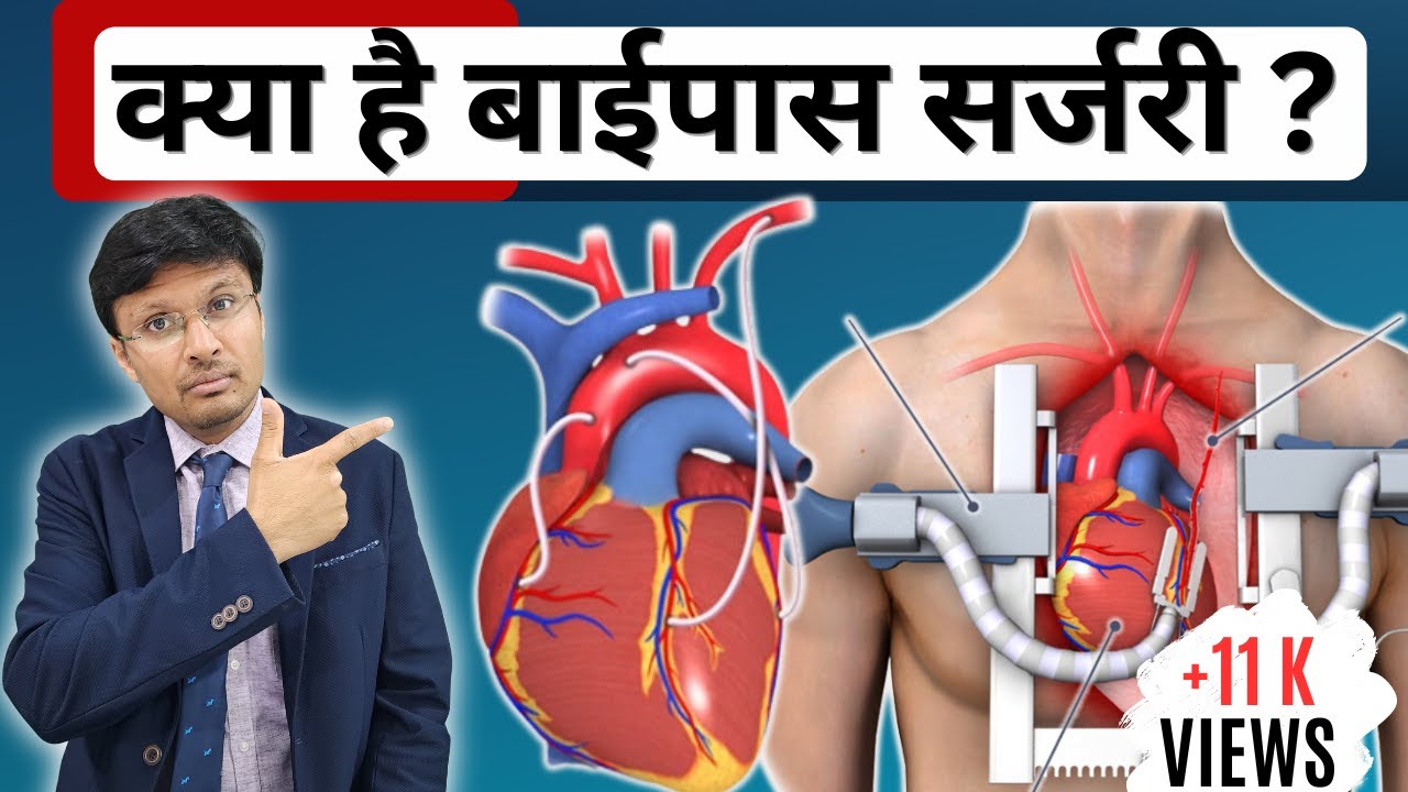 CORONARY ARTERY BYPASS SURGERY :-OVERVIEWOF TECHNIQUE