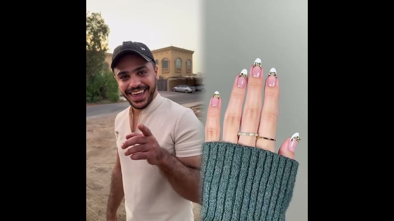 #الطفل الاعمى المعجزه #محضوره_من_الاكسبلور_والمشاهدات #علاوي_مارتن #اكسبلور 15_w🤣👌👌👌