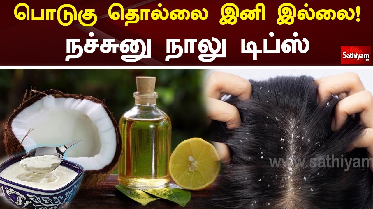 பொடுகு தொல்லை இனி இல்லை! நச்சுனு நாலு டிப்ஸ் | Dandruff | Web Special | Sathiyam Tv