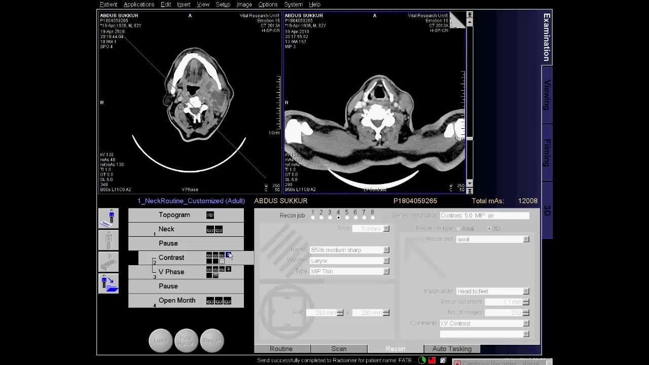 how to make ct scan of Neck Techniq with Filming