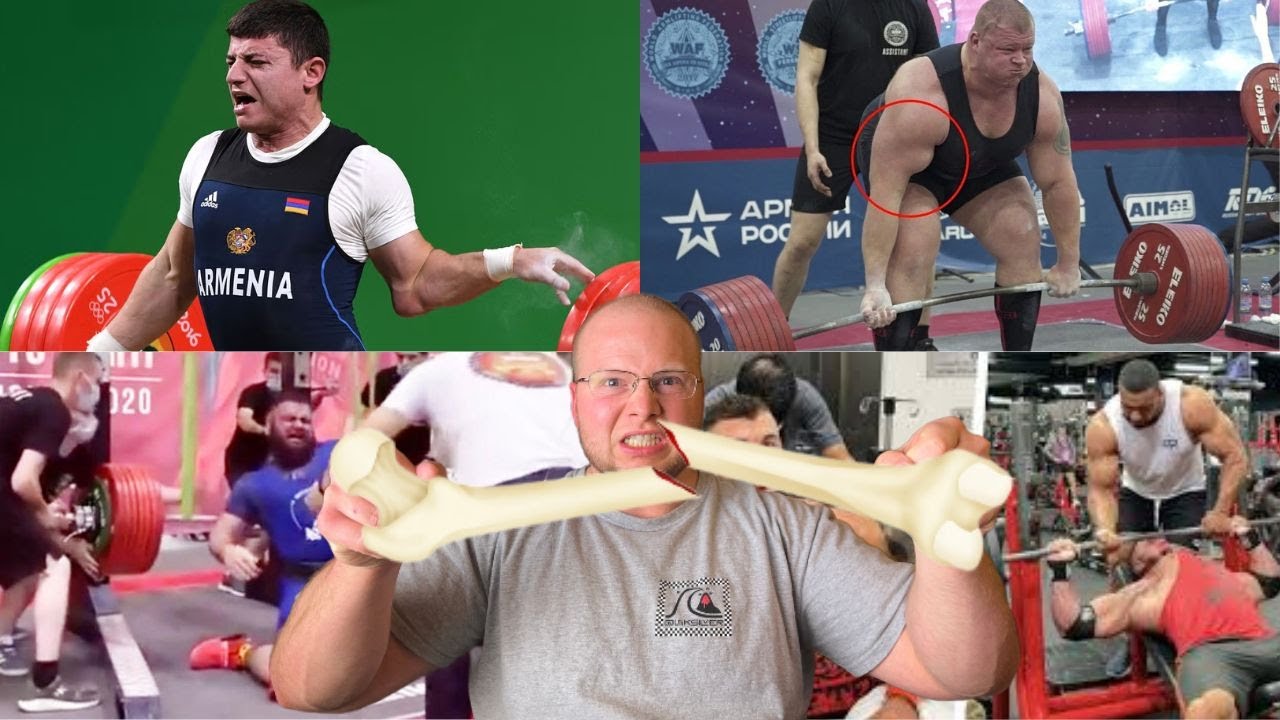 Top 10 Worst Lifting Injuries, EVER.. 😵