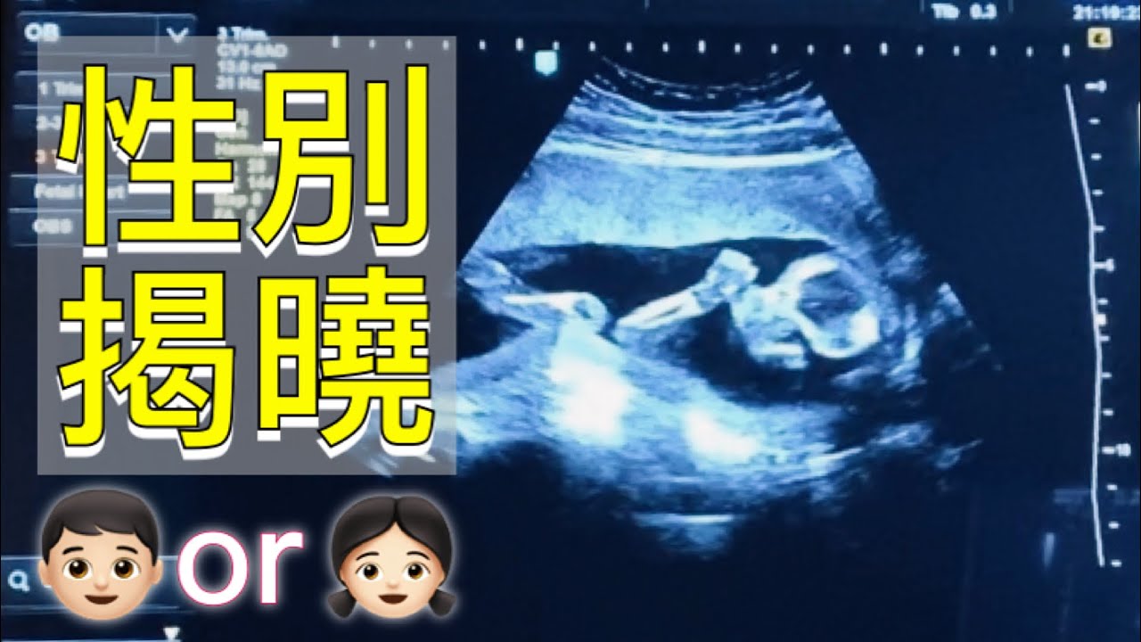 懷孕最期待的事之一｜👶🏻性別｜寶寶日記Baby diary｜山繆與喬伊 |JoyVLife