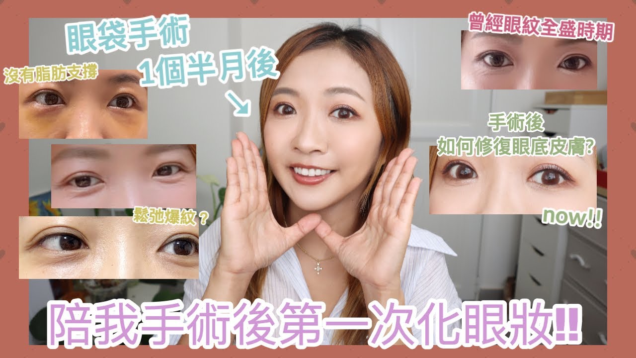 ♥ BYEBYE眼袋#3 ♥ 終於手術後第一次化眼妝👀 公開個月半後素眼狀態💁🏽‍♀️眼袋手術後會爆眼紋？我是如何修復眼底皮膚？ || Dottie Hidee ||(合作)