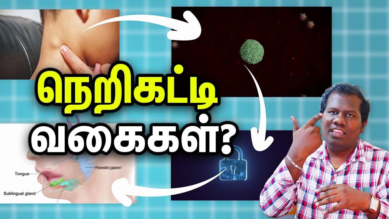 Types of Lymph node  நெறிகட்டி வகைகள்?  Dr Narendran