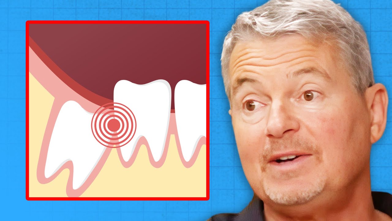 The UNTOLD TRUTH About Wisdom Teeth & Cavitations | Dr. Mark Burhenne