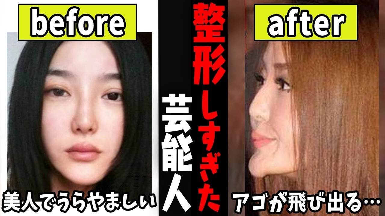 この人も！？整形で顔が変わってしまった芸能人…【ガルちゃん芸能・有益2ch】