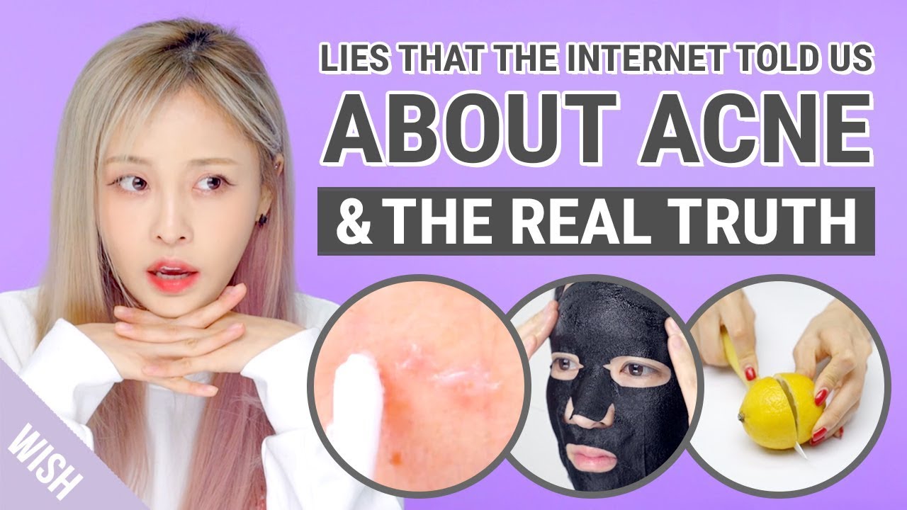 Biggest Acne Truth & Lies | 5 Beauty Myths on Acne