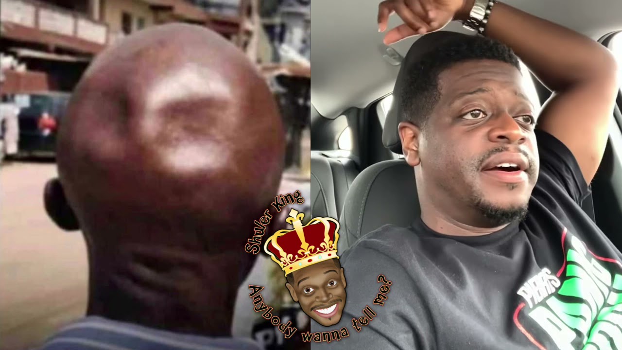 Shuler King - Who Pinched His Head?!