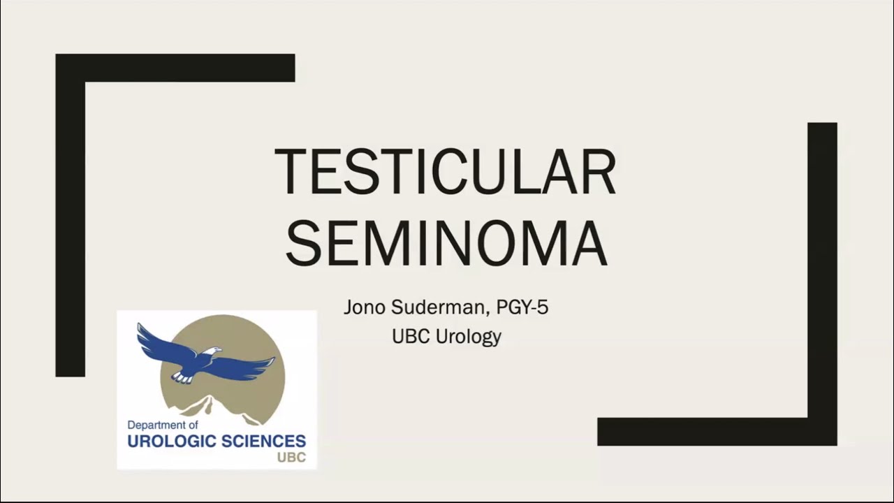Testicular Seminoma