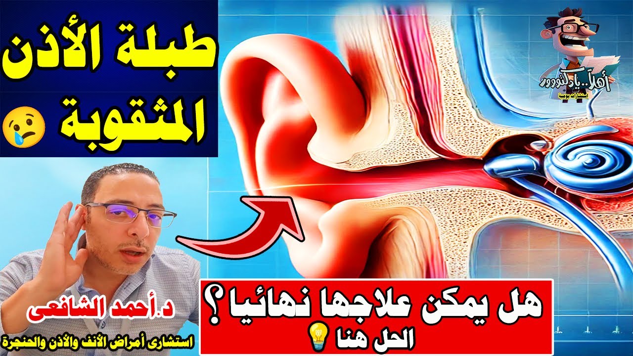 خايف من عمليه ترقيع طبلة الأذن هل تستحق القلق؟ | اهلا يا دكتور تخصص امراض الأنف والأذن والحنجرة