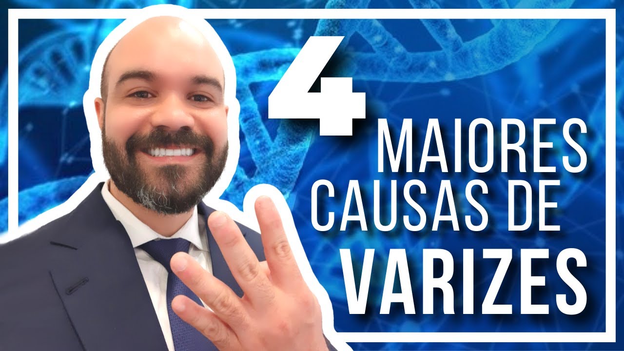 🔴  As 4 maiores Causas das Varizes [DEFINITIVO]