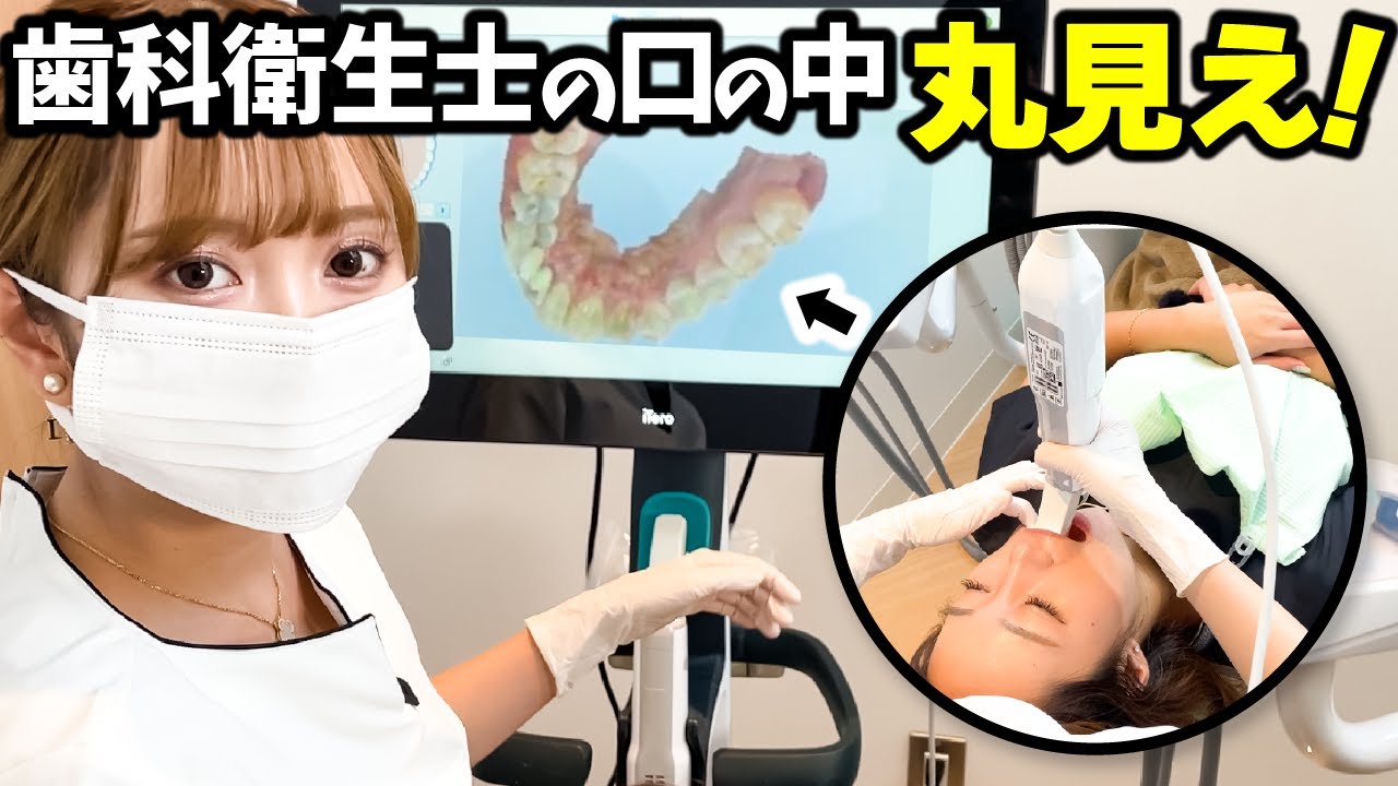 【実演】相方の歯をガチでアイテロスキャンしてみたら意外な結果に…ｗｗｗ【iTero】