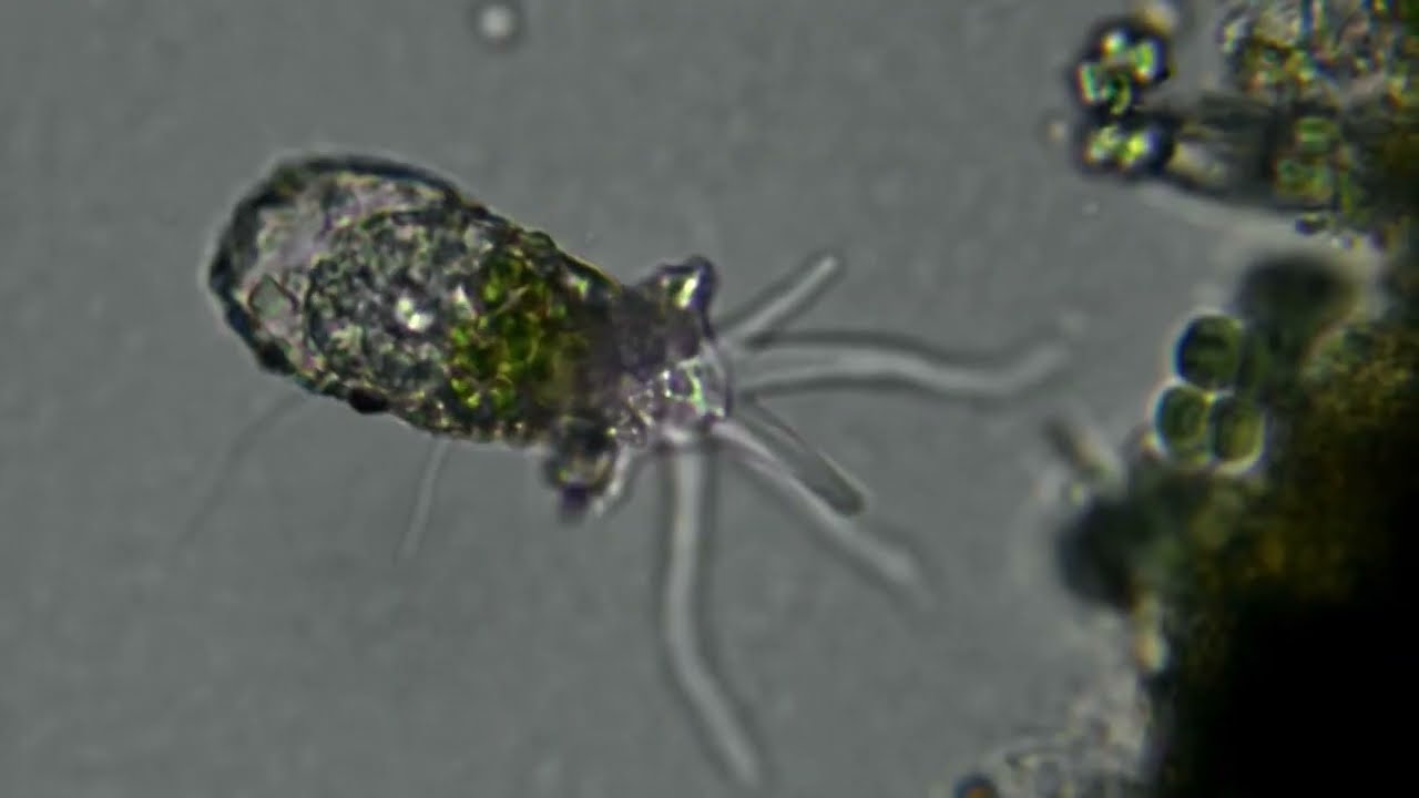 Testate amoeba x5