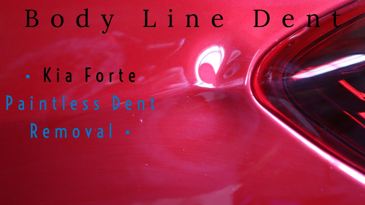 Kia Forte Compound Dent On Body Line Repaired Paintless Dent Removal