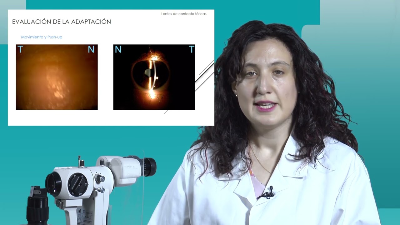 1 Adaptación de Lentes de Contacto Blandas Tóricas
