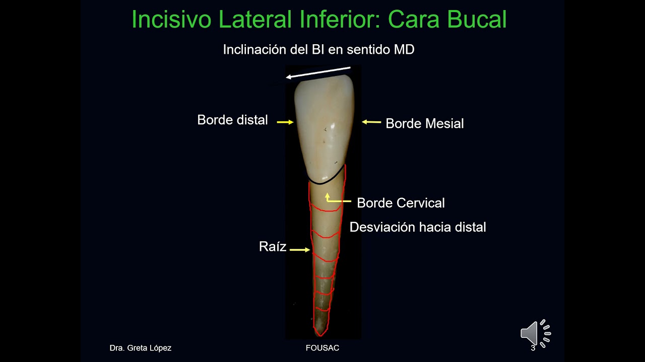 Incisivo Lateral Inferior 2021