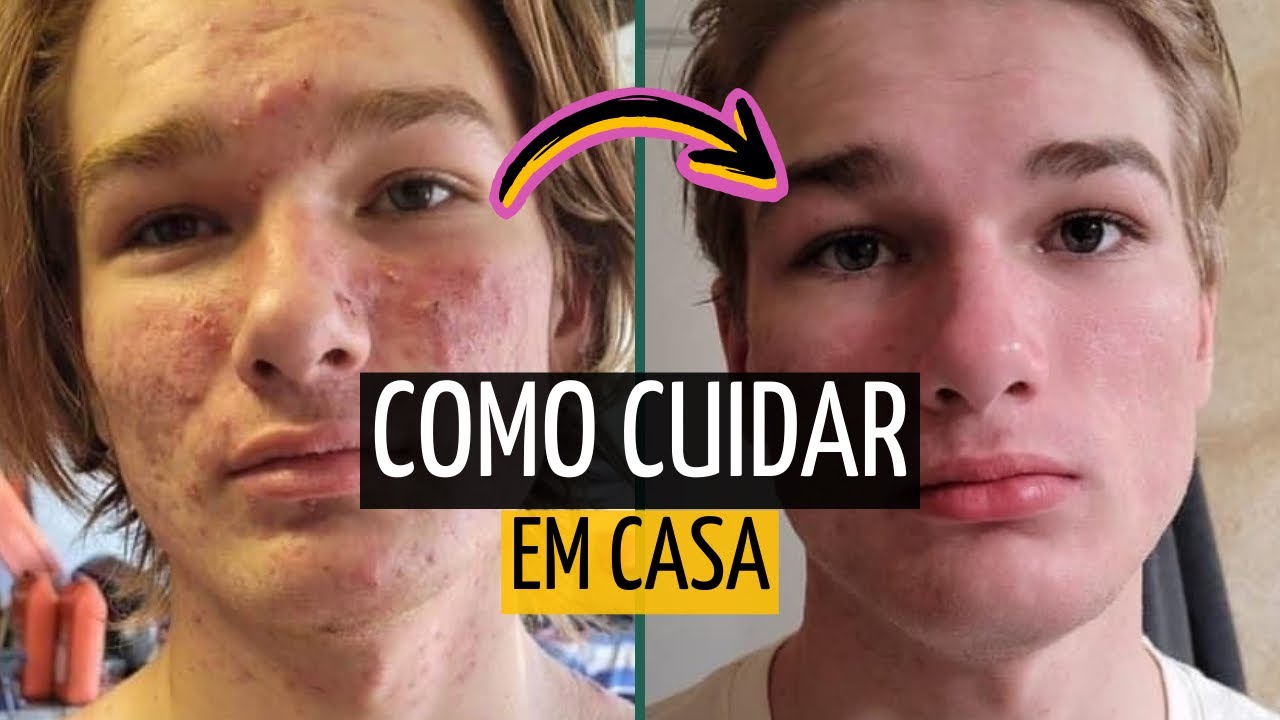 O que PASSAR NO ROSTO e FICAR BONITO | Skincare e Glow Up