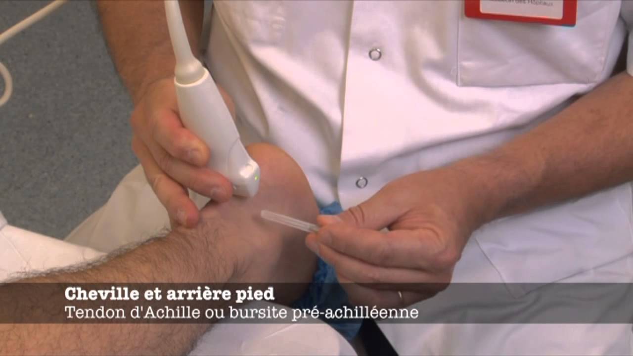 Echoms.info - Tendon d’Achille et bursite pré-achilléenne