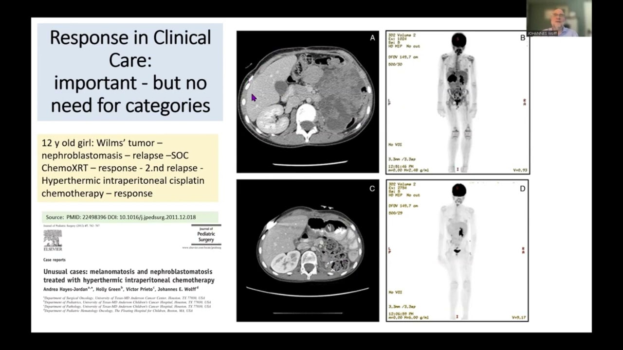Response in cancer trials - overview and examples