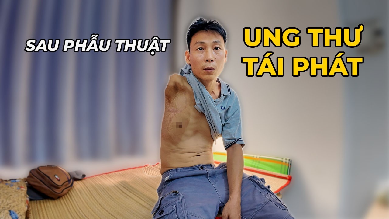 561. Sau Phẫu Thuật, Ung Thư Tái Phát Khi Tết Đã Gần Kề