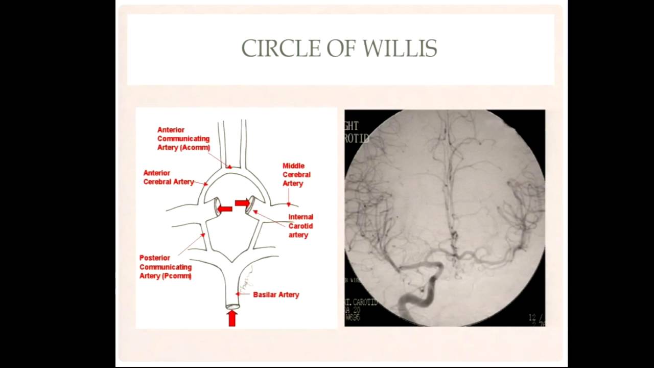 Principles of Carotid Stenting (Alpesh Shah, MD) April 15, 2016
