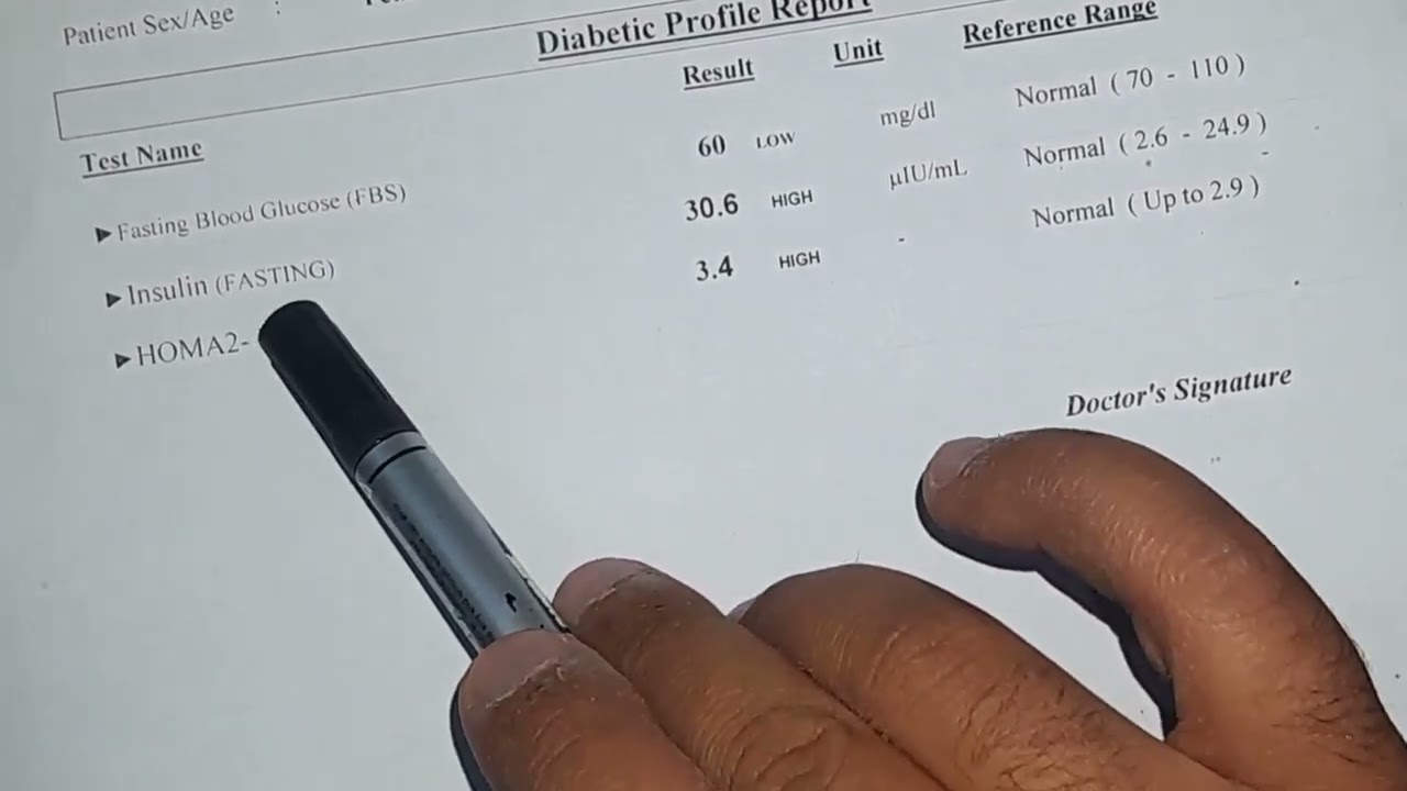 قراءة تحليل مقاومة الانسولين Homa IR