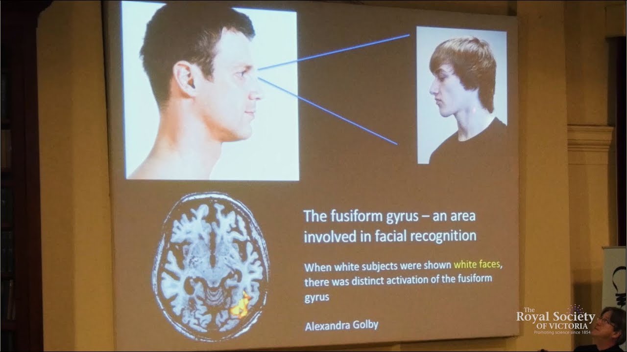 You and Your Racist Brain: The Neuroscience of Prejudice