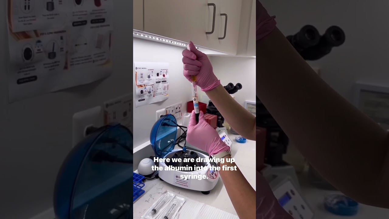 PRF Gel Preparation