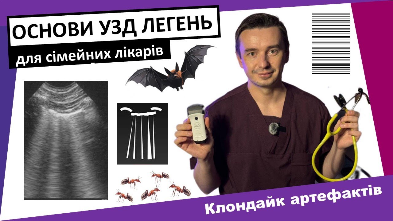 УЗД ЛЕГЕНЬ та сімейний лікар. POCUS. #УЗД #Ультразвук #Легені #Пневмонія #Ultrasound #ProAS
