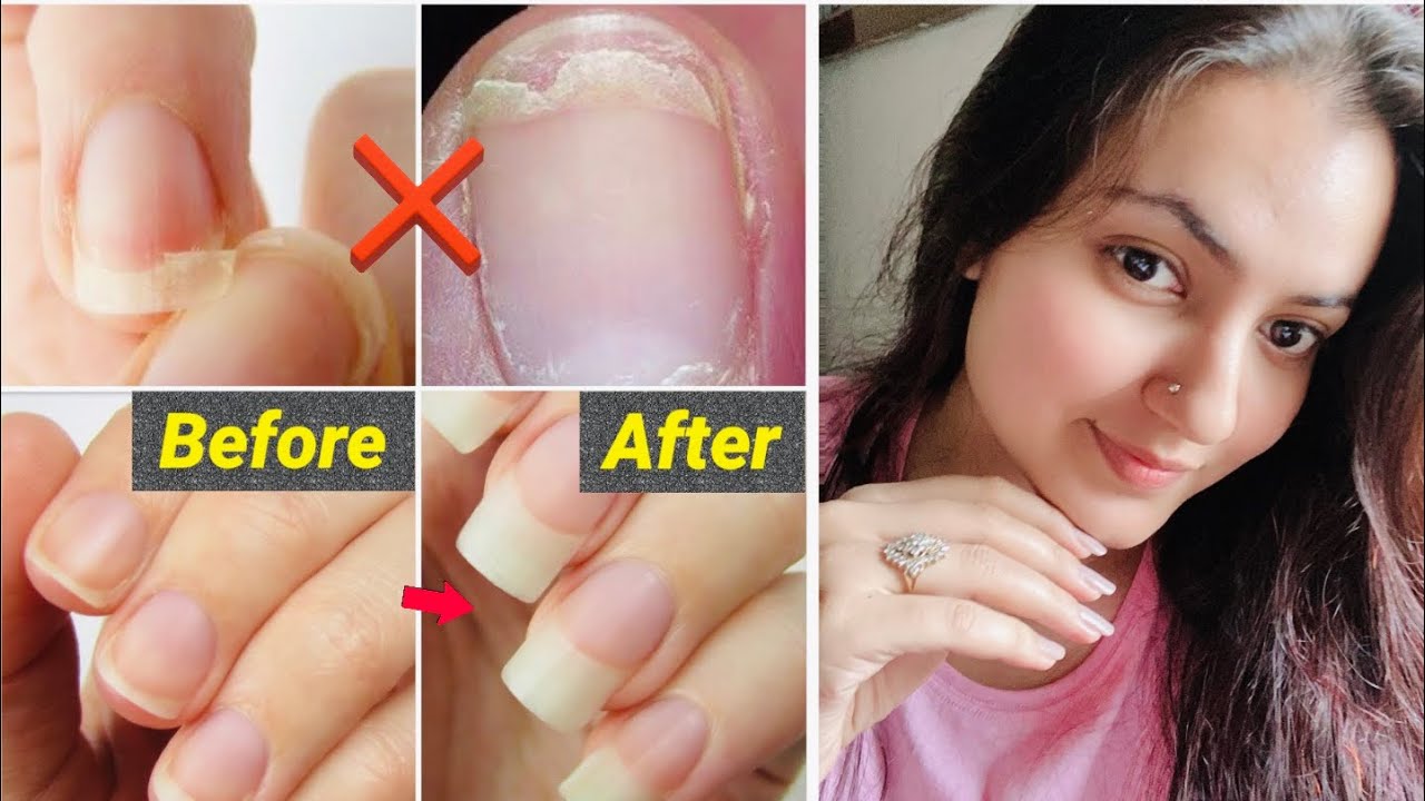 5 Days Nail Growth Challenge : Grow long & Strong Nail Fast at Home | All About Nail Care