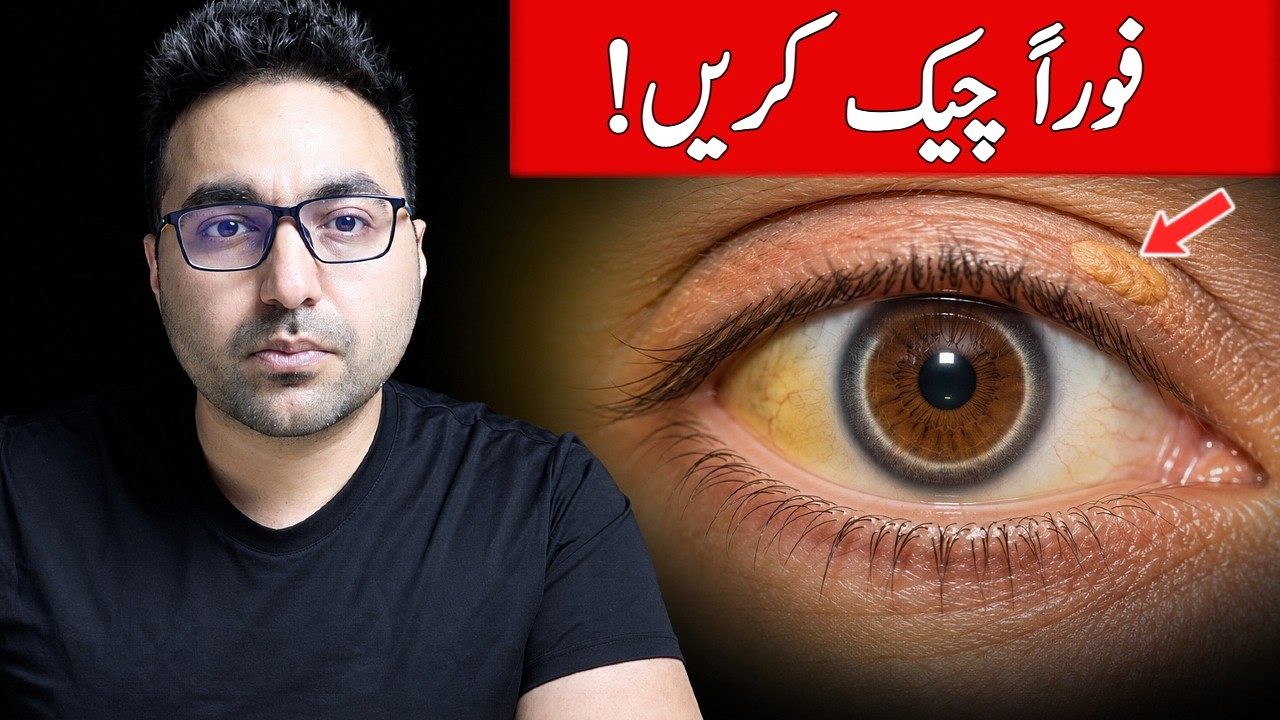 Check Your Eyes: WARNING Signs! | Dr. Zee