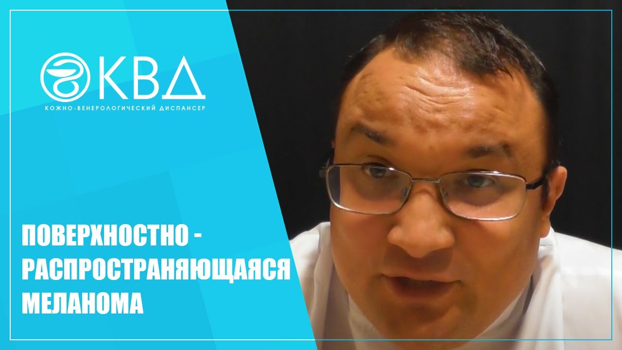 1359  Поверхностно-распространяющаяся меланома