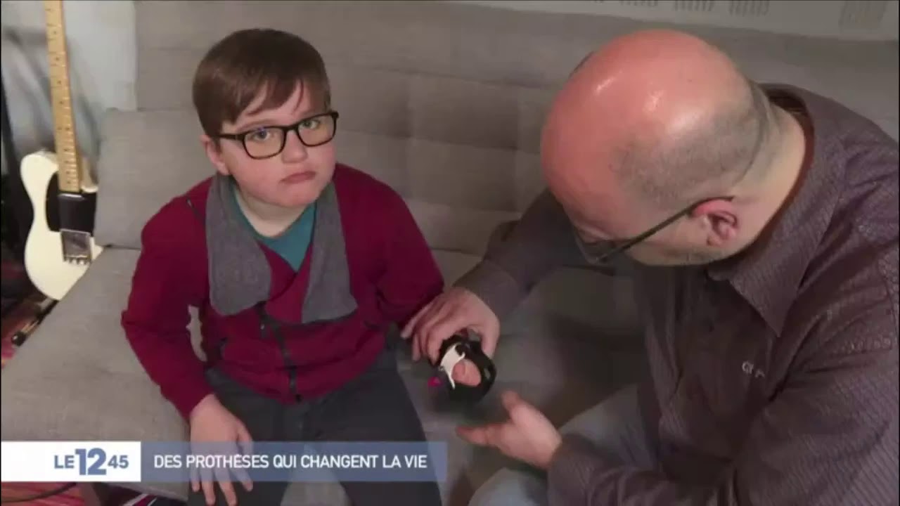 E-nable offre des prothèse imprimées en 3D aux enfants - Dagoma