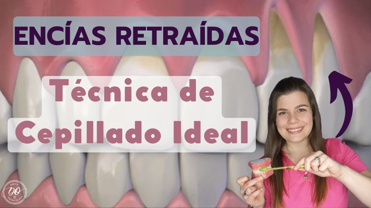 ✅ Cómo CEPILLAR los dientes con ENCÍAS RETRAÍDAS en 2023 🦷