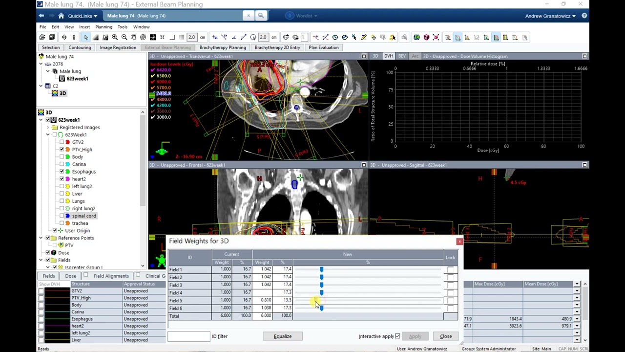Week 1 - 3D vs IMRT Lung
