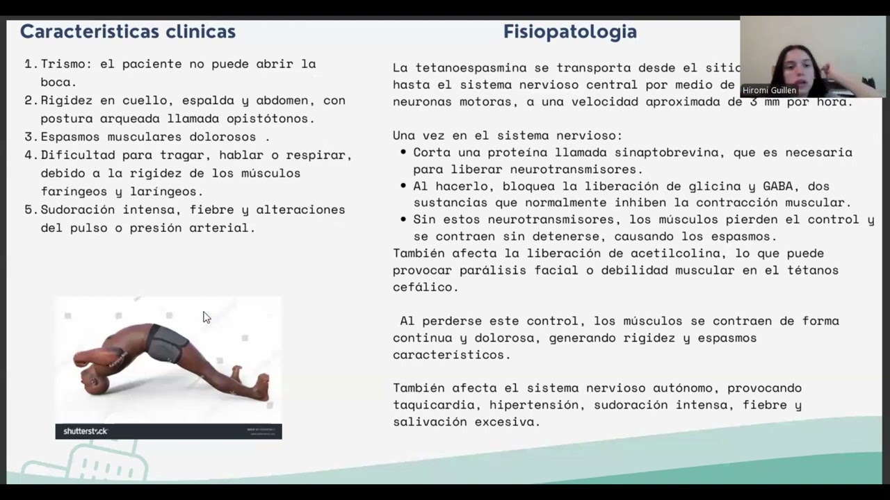 intromed video tetano