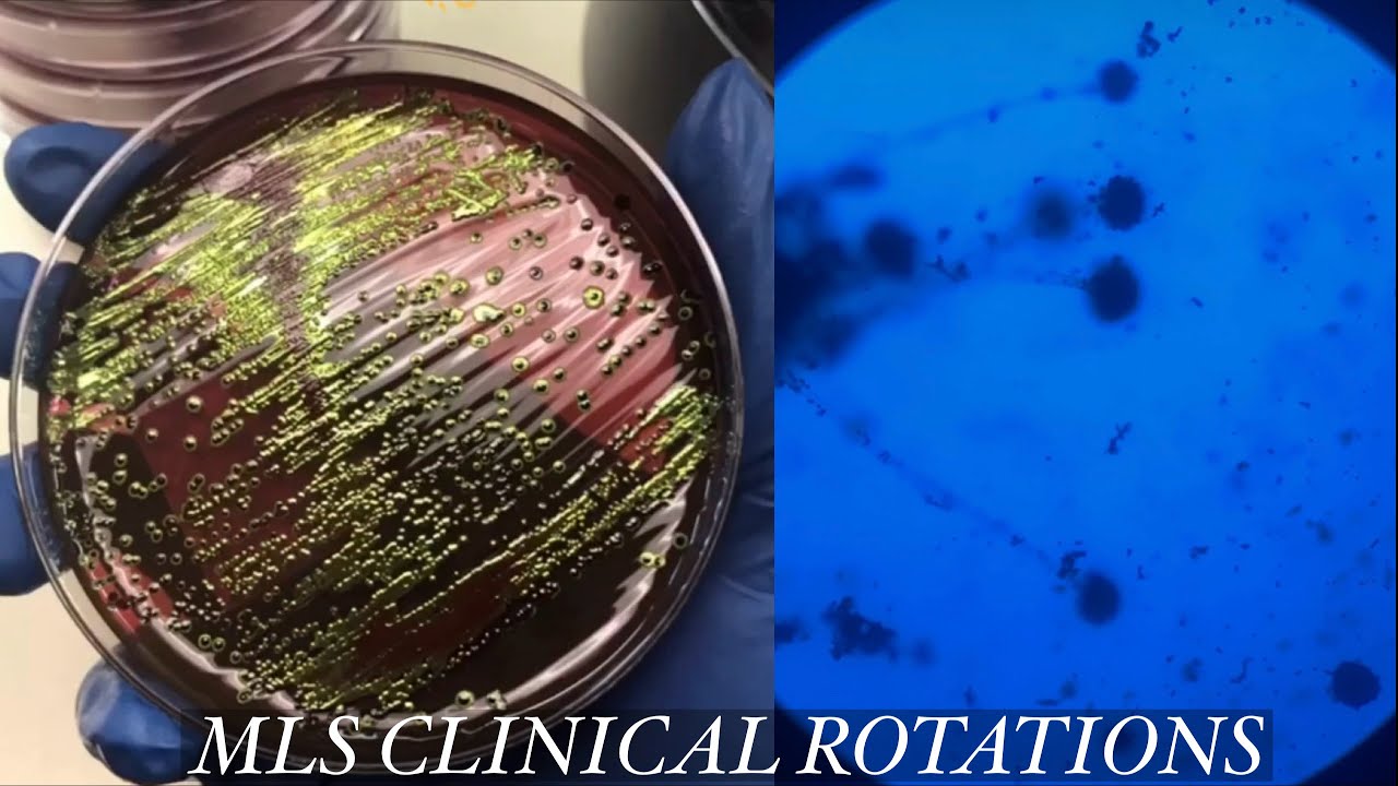 What I Did in my Medical Laboratory Science Clinical Rotations | Very Detailed 🧪🩸💉🔬👩🏾‍🔬