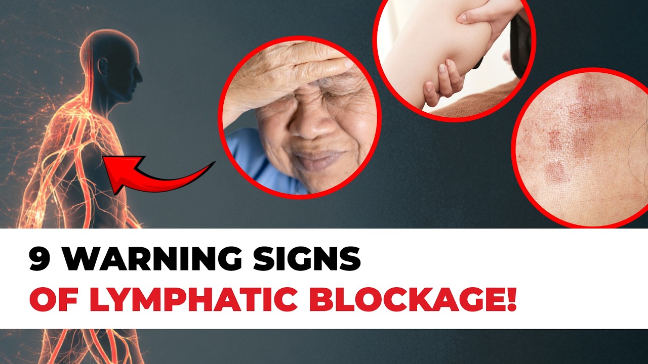 Lymphatic Congestion Signs & How to Improve Lymphatic Flow Naturally | NHMD