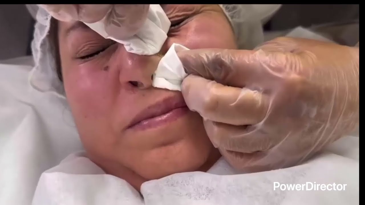 ايام البقة كانت عايشة الحياةو بعلها فحبيبيس تيشبع برودة🫣🤣تعكر و تكحل وتلبس ذهبها😍 البقة دفن ها حية 