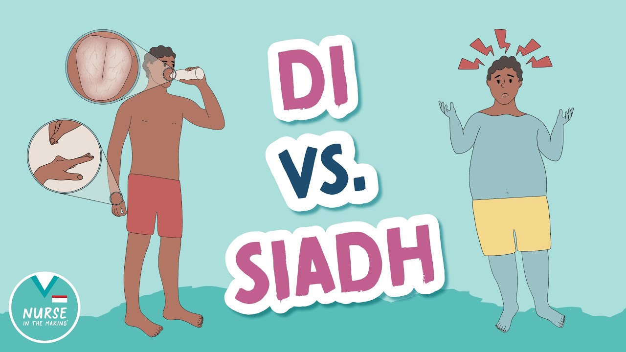 SIADH против DI &mdash; признаки и симптомы | Помощь Med Surg для медучилищ